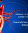 Minimally Invasive Coronary Artery Bypass Surgery vs Conventional Coronary Artery Bypass Surgery